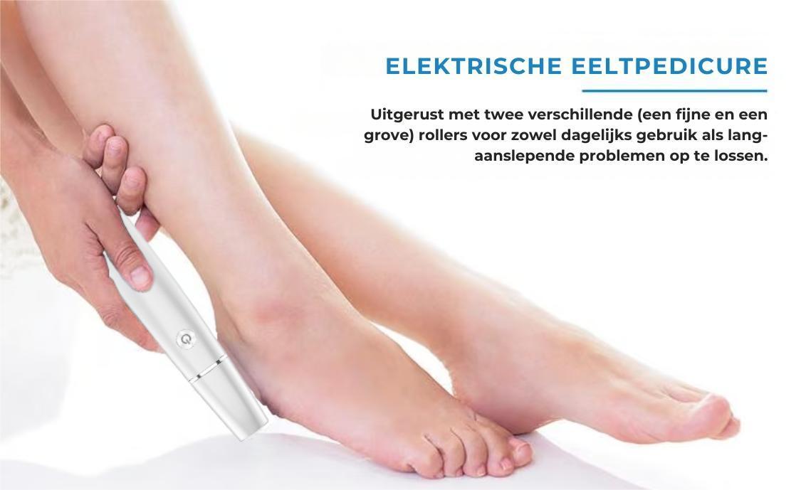 Elektrische eeltverwijderaar π Inclusief vervangende kopπ