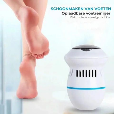 SmoothSole - Elektronische Voet-Eeltverwijderaar