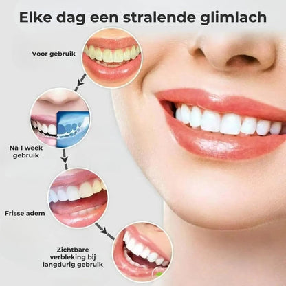 4-in-1 monddouche zonder snoer