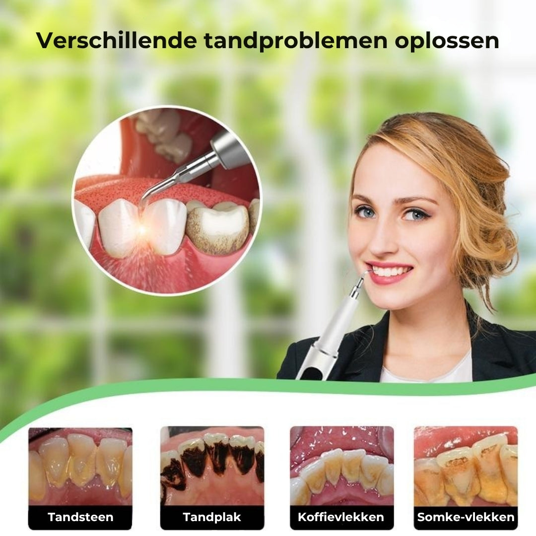 Ultrasone elektrische tandreinigingspen
