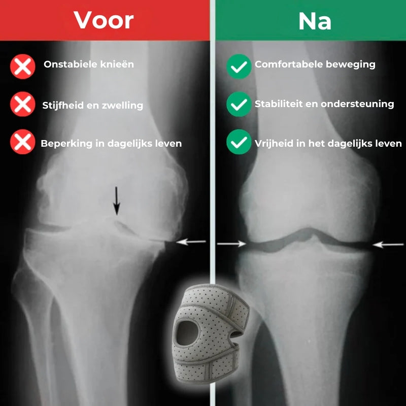 OrthoKnie Pro™ – Voor een dagelijks leven zonder kniepijn