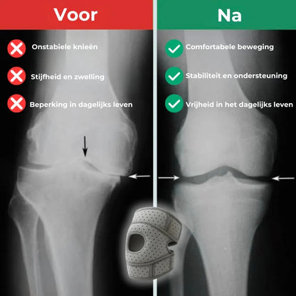 OrthoKnie Pro™ – Voor een dagelijks leven zonder kniepijn