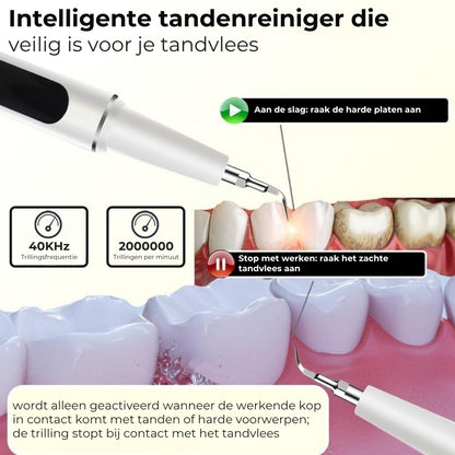 Ultrasone elektrische tandreinigingspen