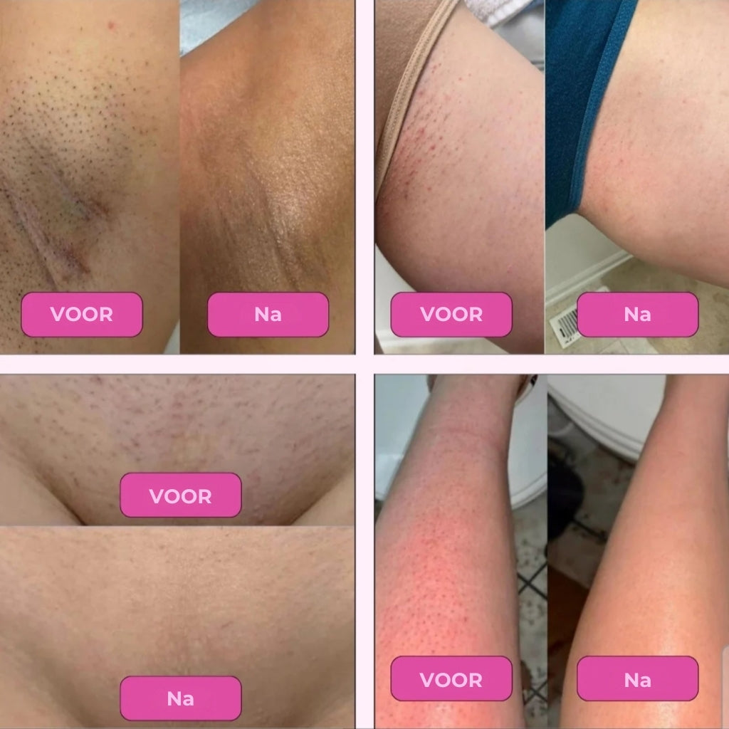 SmoothShave - Glad scheren scheerapparaat