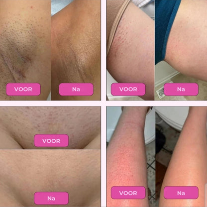 SmoothShave - Glad scheren scheerapparaat
