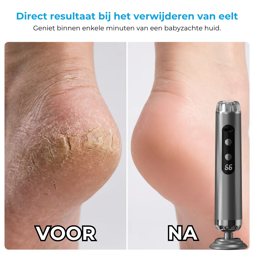 Elektrische voetslijpmachine met 5 snelheden