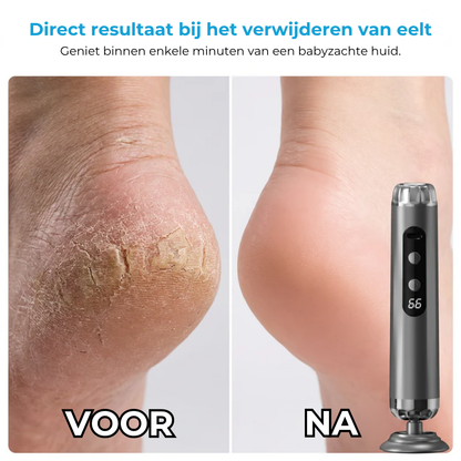 Elektrische voetslijpmachine met 5 snelheden