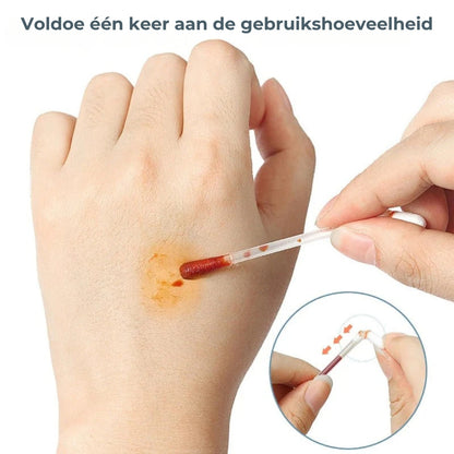 Jodium Wattenstaafjes - 50 Stuks