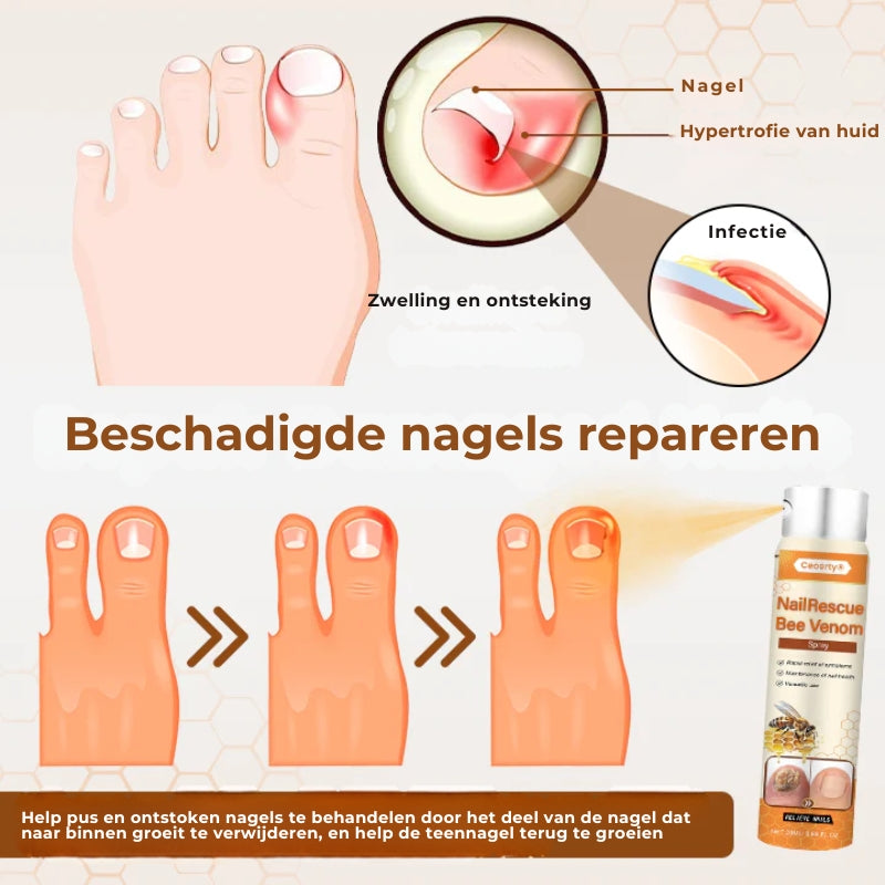 Crucial® NailRescue Nagel Spray