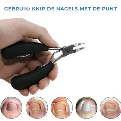 Medische Nagelknipper